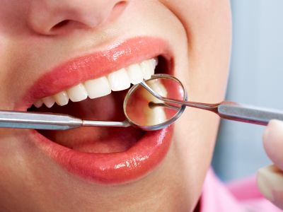 Dental Hygiene Services in North York