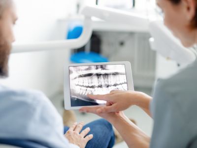 Digital X-Rays in North York